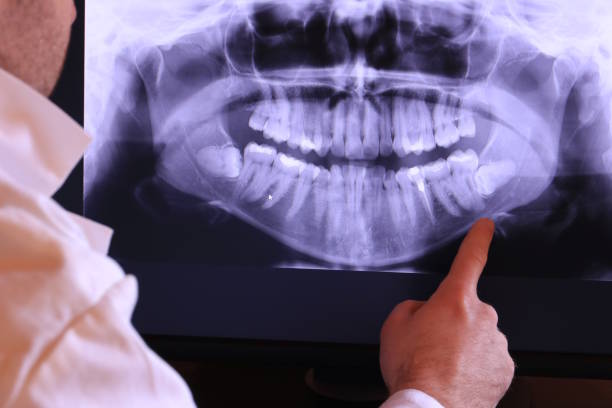 Best Tooth Pain Emergency Relief  in Bulverde, TX